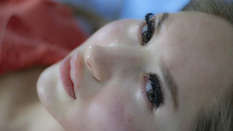 Come sbarazzarsi di cicatrici e cicatrici rapidamente